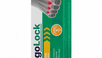 Fungolock – einzigartige und unwiederholbare Lösung, um Pilze von Zehennägeln zu entfernen